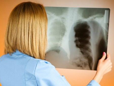 Жители Воронежской области смогут получить консультацию по профилактике туберкулёза
