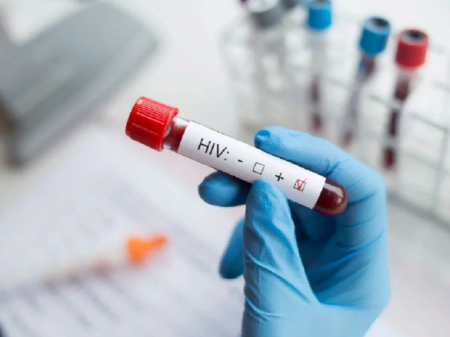 В 2020 году в Воронежской области выявили ВИЧ у 383 человек